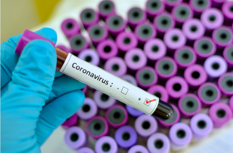 Coronavirus positivo